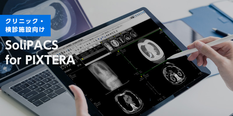 SoliPACSfor PIXTERAクリニック・検診施設向けPACS 地域連携機能を搭載した 新しい医用画像管理システム