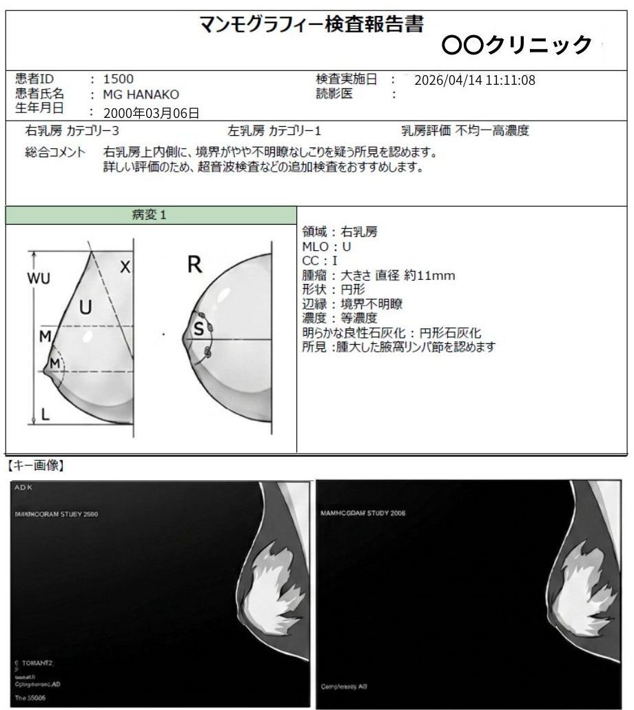 SoliReportレポート参考画像